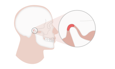 Kiefergelenk in zentrischer Position